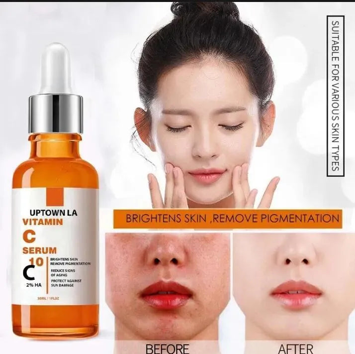 Uptown La Vitamin C Serum 10% – Brightening Glow Skin Care