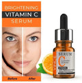 Vitamin C Serum for Dark Spot Removal & Brightening 30ml